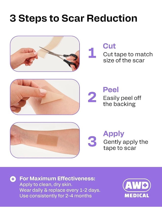 AWD Medical AWD Medical Soft Silicone Tape for Scars Removal with Silicone Gel Sheeting (1.6inx 120in)  - Image 3