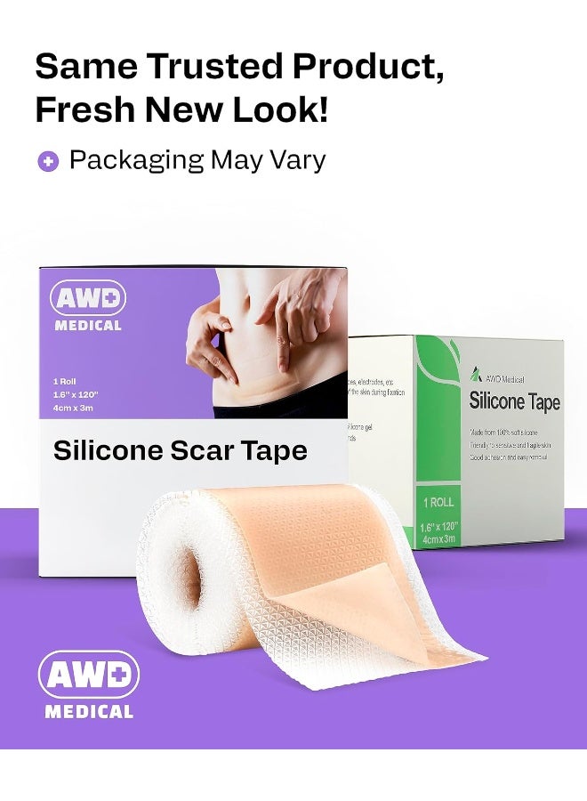 AWD Medical AWD Medical Soft Silicone Tape for Scars Removal with Silicone Gel Sheeting (1.6inx 120in)  - Image 5