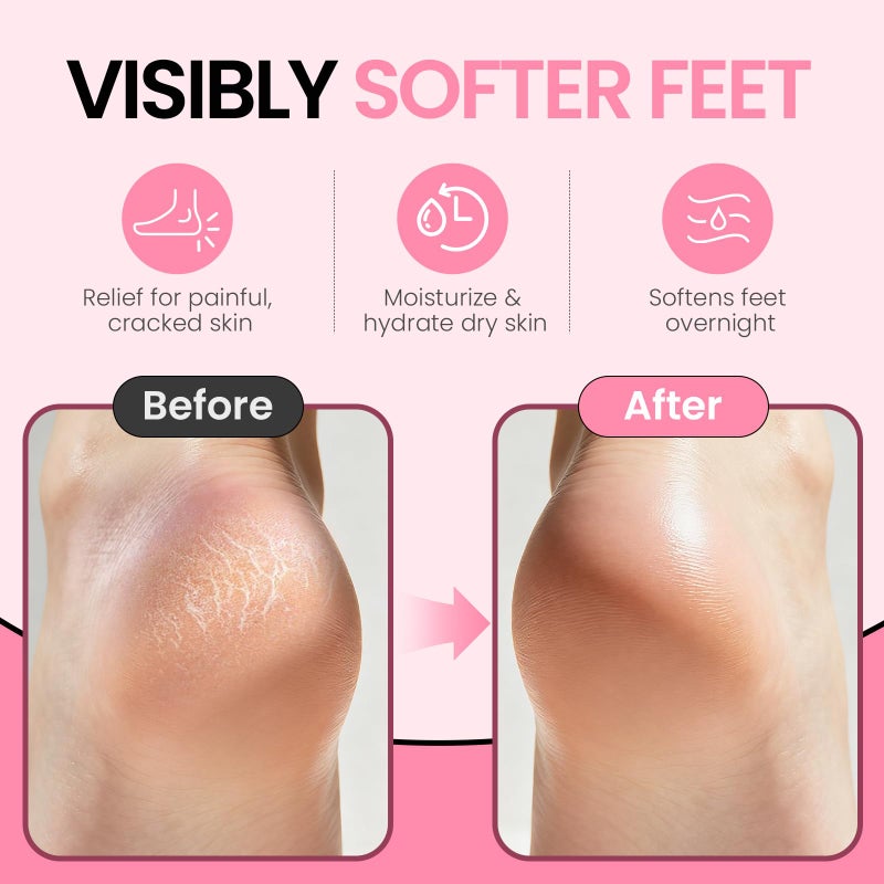 ALUROICE Silicone Moisturizing Socks for Women Large- 2Pairs Foot Moisturizer Socks for Dry Cracked Feet- Pink Aloe Spa Moisture Hydrating Foot Care Socks (L Up to Size 12) - Image 3