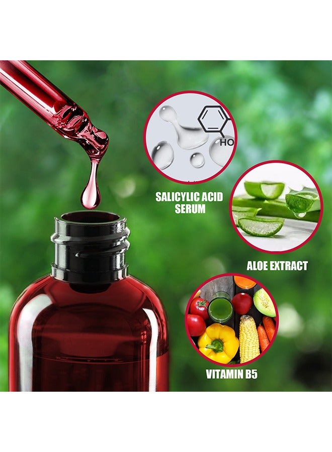 EELHOE AHA30%+BHA 2% salicylic acid essence,Tone Moisturizing Repair, Powerfulexfoliation and Deepcleamsingofpores, 30ml - Image 2