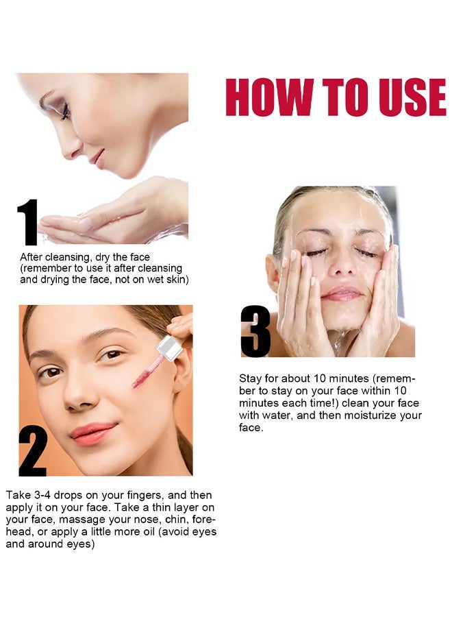 EELHOE AHA30%+BHA 2% salicylic acid essence,Tone Moisturizing Repair, Powerfulexfoliation and Deepcleamsingofpores, 30ml - Image 3