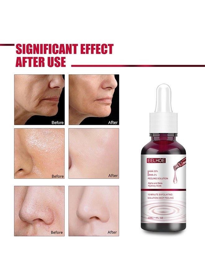 EELHOE AHA30%+BHA 2% salicylic acid essence,Tone Moisturizing Repair, Powerfulexfoliation and Deepcleamsingofpores, 30ml - Image 4