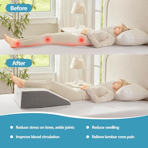 Nordjager Leg Pillow for Elevation & Support, 24"x22"x10" Memory Foam Cushion with Grey White Patterned Polyester Cover, Ideal for Improving Circulation & Relaxing Leg - Image 2