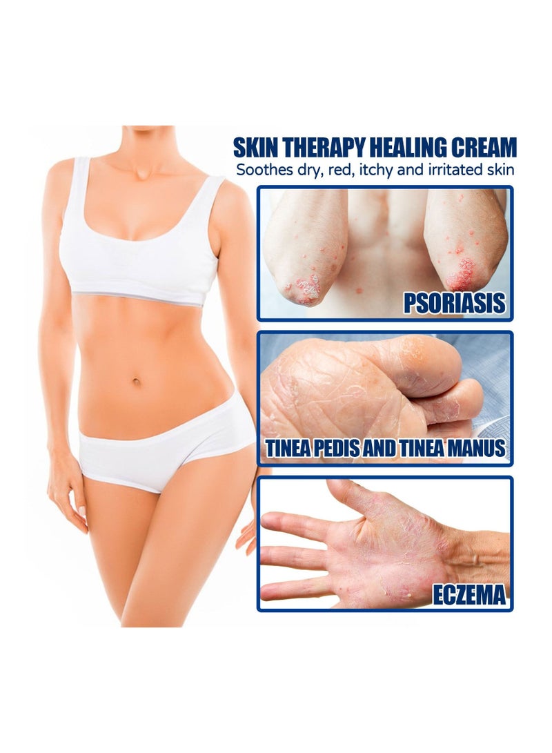 SOUTH MOON كريم علاج البشرة 20 جرام - Image 4