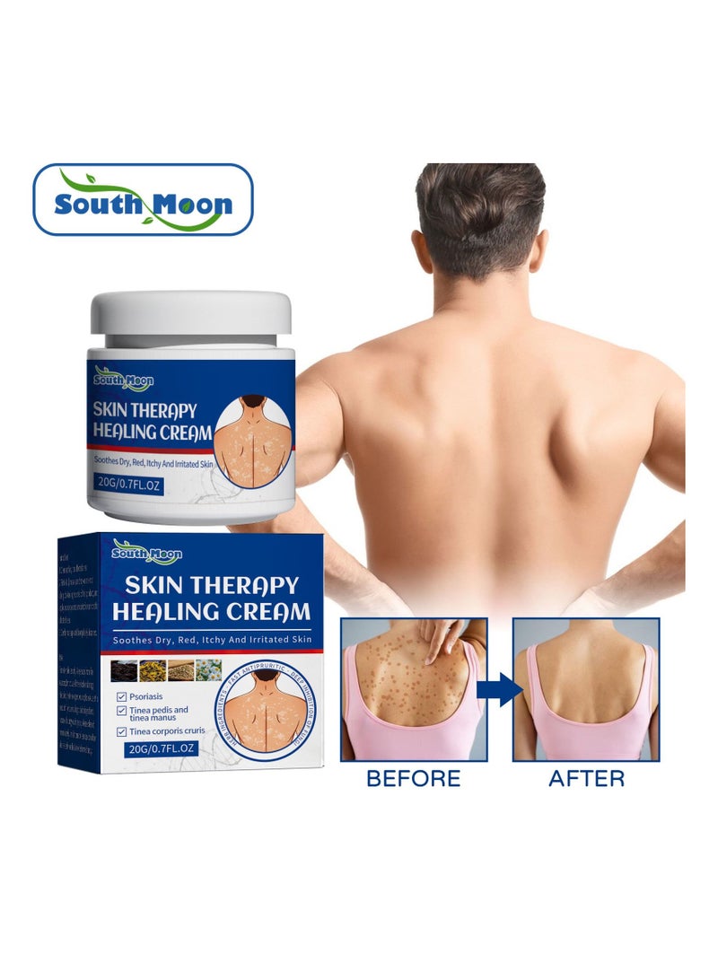 SOUTH MOON كريم علاج البشرة 20 جرام - Image 5
