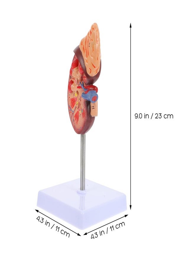 Amosfun Kidney Model Human Kidney Dissection Model Human Organs Anatomy Model Biology Demonstration Model Biology Class Accessory PVC Human Organ Model - Image 2