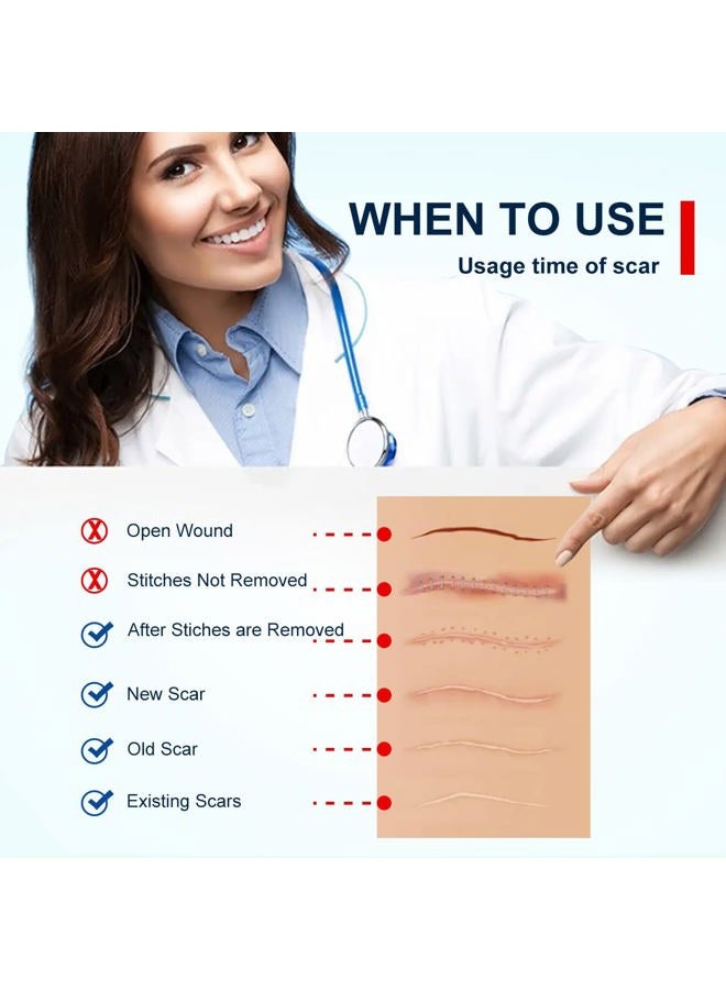 ZODENIS Silicone Scar Sheets(1.8” x 157”Inch- 4M), Scar Tape, Scar Strips, Medical Grade, Scar Remover, C-Section, Surgery, Keloid, Tummy Tuck, Scar Patch. - Image 3