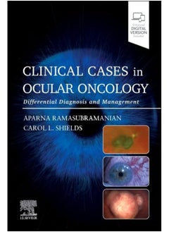 Clinical Cases in Ocular Oncology: Differential Diagnosis and Management 