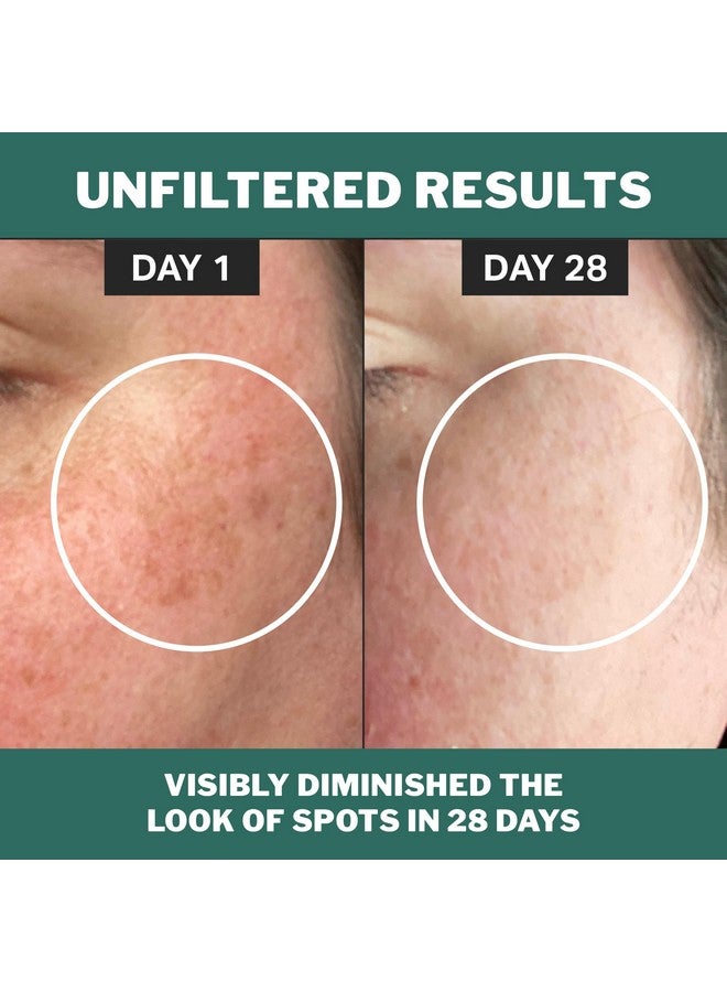 كوكو كايند مصل الكلوروفيل لتغير اللون، مصل تلاشي البقع الصديق للبشرة الحساسة لاستهداف البقع غير المتساوية والاحمرار، 1 أونصة سائلة - Image 4