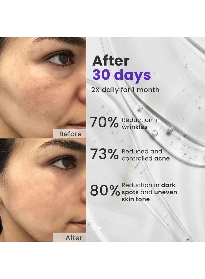 Saffr'n Anti Ageing Serum with Saffron extract, 5% Niacinamide, Peptides, Lactic Acid, Centella Asiatica to Reduce Ageing Signs | 30 ml - Image 3