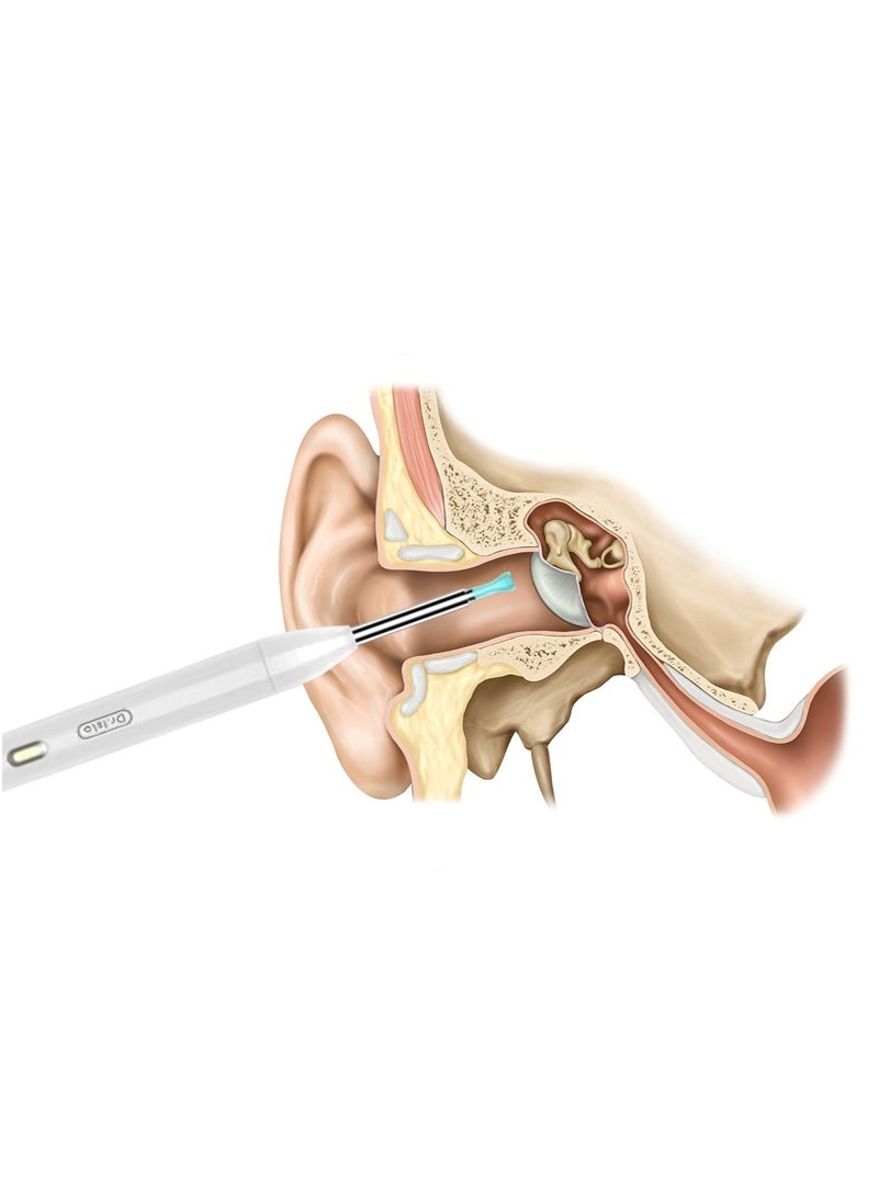Dr.isla منظف الأذن الذكي Dr.isla P2 بتقنية WiFi – أداة تنظيف شمع الأذن بالمنظار مع كاميرا بدقة 300W وملحقات - Image 2