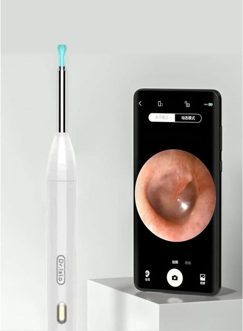 Dr.isla منظف الأذن الذكي Dr.isla P2 بتقنية WiFi – أداة تنظيف شمع الأذن بالمنظار مع كاميرا بدقة 300W وملحقات - Image 1