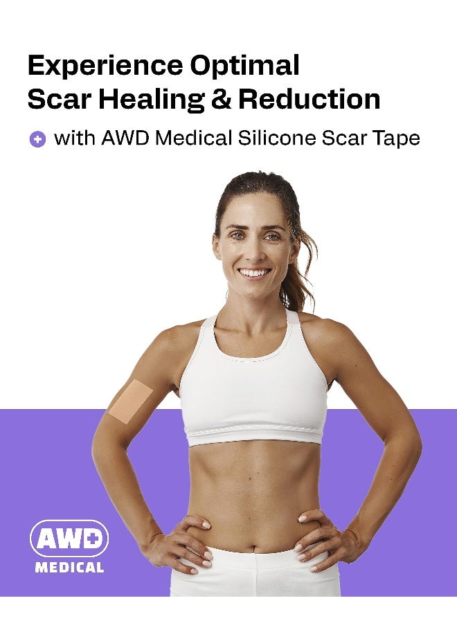 AWD Medical AWD Silicone Scar Sheets for Surgical Scars Medical Grade Silicone Scar Tape for C Section Tummy Tuck Tape Keloid Treatment Silicone Skin Patches After Surgery Must Haves 16 x 120 Roll - Image 2