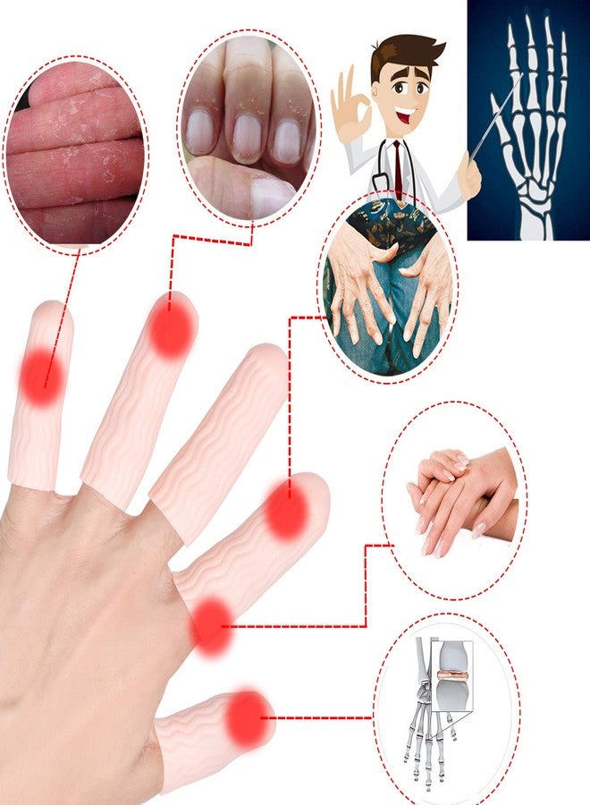 Pnrskter Finger Cots, Gel Finger Tips Protector, Finger Covers (14PCS, L size), New Material (Latex-Free), Finger Sleeves Great for Finger Cracking, Dermatitis, Psoriasis, Hand Eczema and More. - Image 2