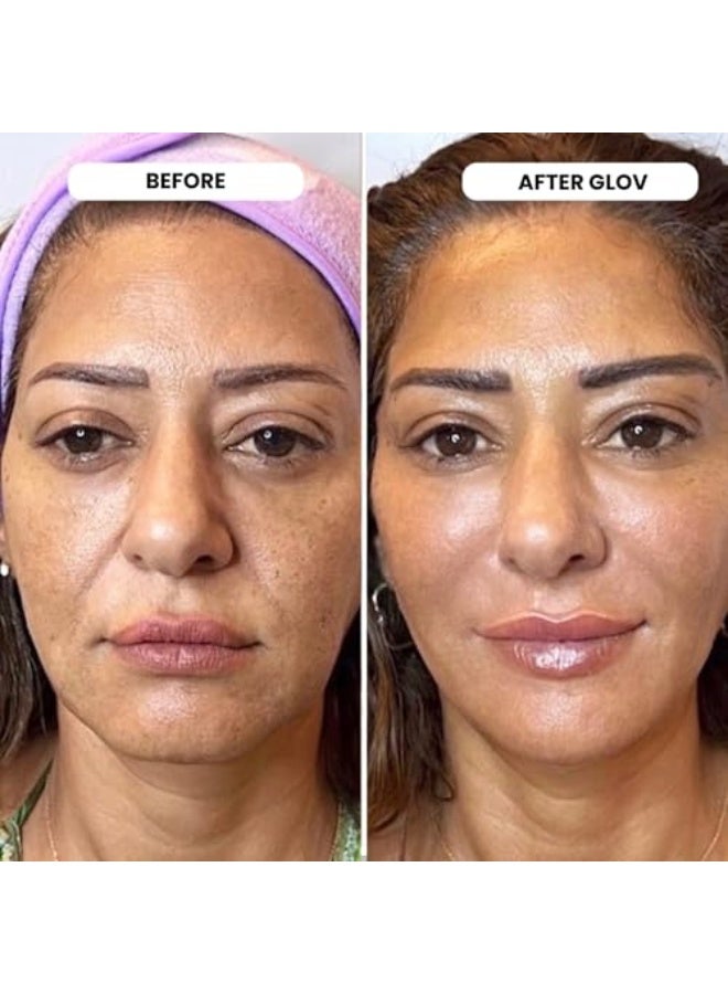 جلوف Glov Beauty، محلول مضاد للشيخوخة يعمل بتقنية الإبر الدقيقة،  نظام التسريب الدقيق - ختم تجميلي للوجه من الذهب عيار 24 قيراط بسمك 0.25 مم مع أمبولات سيروم حمض الهيالورونيك والببتيد - مجموعة ترطيب وتنعيم للوجه والشفاه للاستخدام المنزلي - Image 2