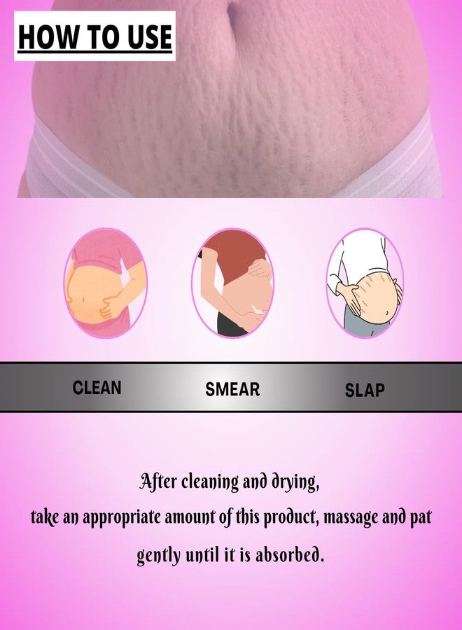 Smartdrops Stretch Mark Cream to Reduce Stretch Marks 60ml (Pack of 1) - Image 4