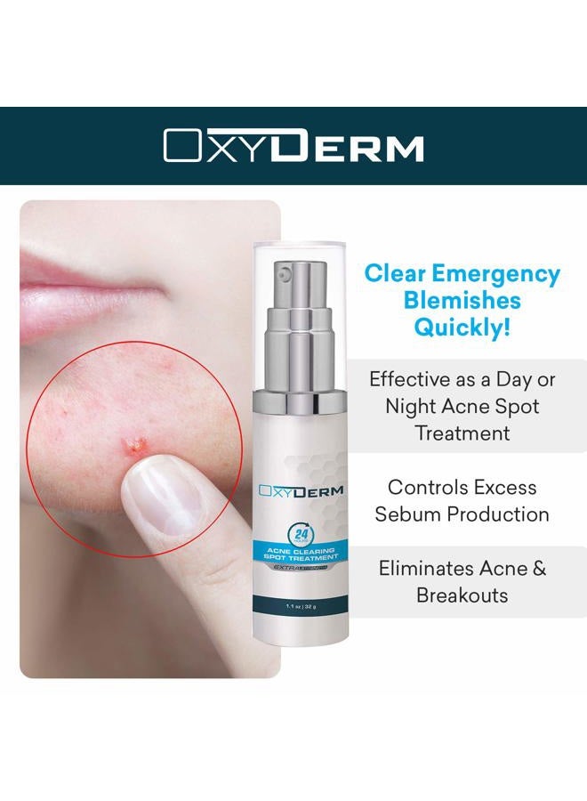 OxyDerm Acne Spot Treatment- Overnight Pimple Treatment for All Skin Types without Over Drying your Skin. Removal for Inflamed Blackheads, Whiteheads, Cystic Acne. Results within Hours for Adults & Teens. - Image 4