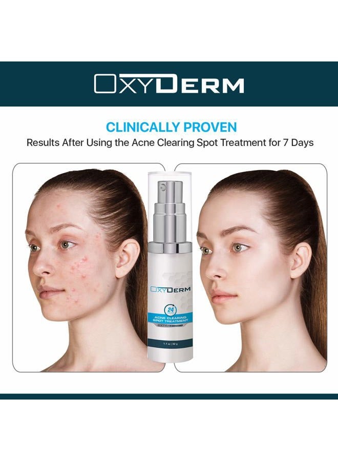 OxyDerm Acne Spot Treatment- Overnight Pimple Treatment for All Skin Types without Over Drying your Skin. Removal for Inflamed Blackheads, Whiteheads, Cystic Acne. Results within Hours for Adults & Teens. - Image 5
