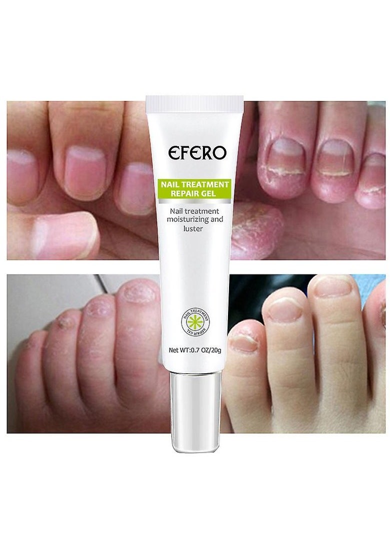 Efero Nail Treatment Repair Gel 20g
