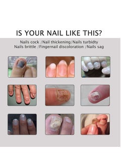 efero Efero Nail Treatment Repair Gel 20g  - Image 5