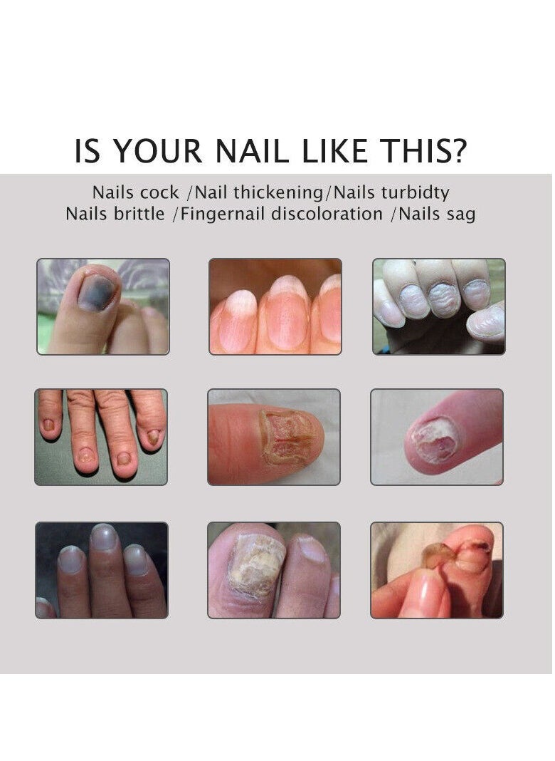 Efero Nail Treatment Repair Gel 20g