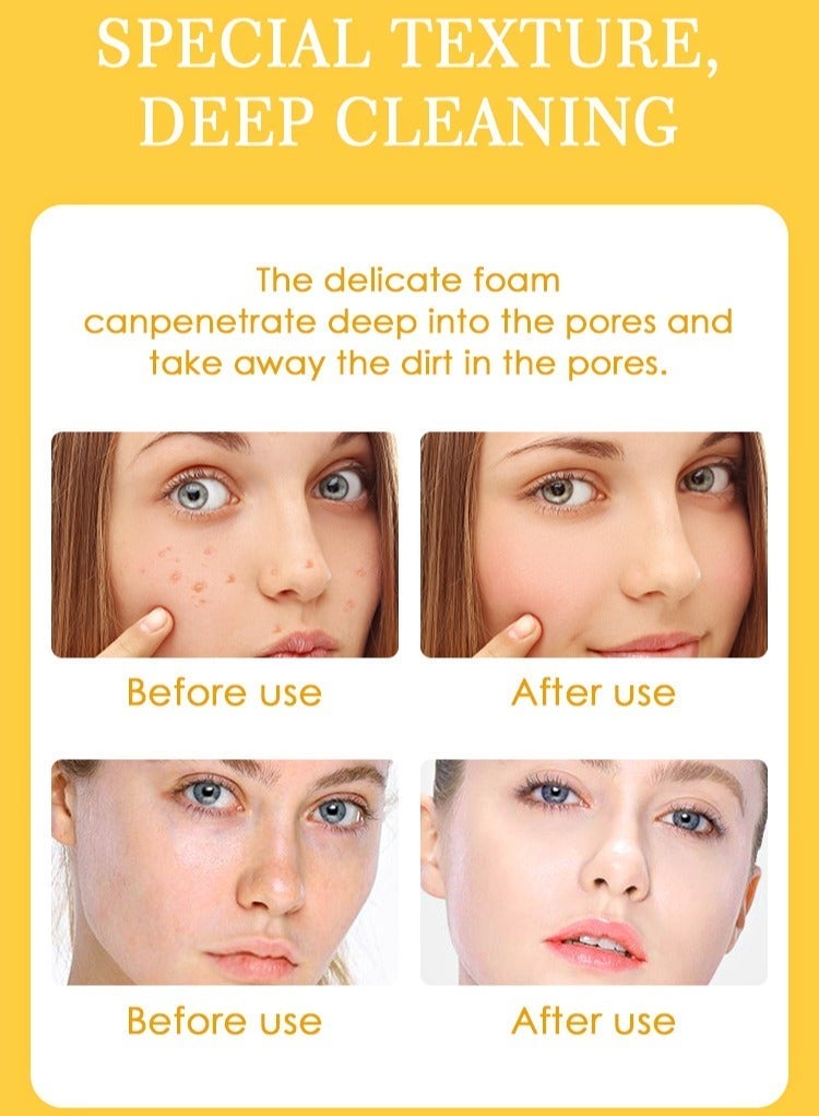 MOOYAM Turmeric Face Wash Gel 100ml Acne Treatment and Deep Cleaning Pore Cleanser for Whitening and Clear Skin - Image 3