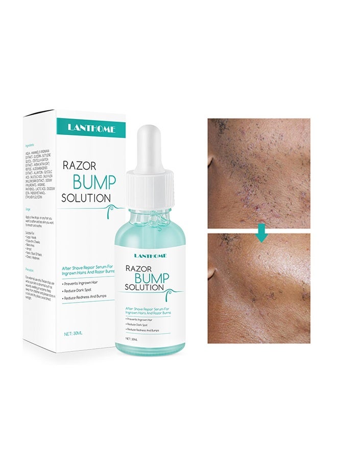 Lanthome Razor Bump Solution,Hair Growth Inhibitor Safe and Gentle Repair serum, Delay Hair Growth, No Black Spots 30ml - Image 1