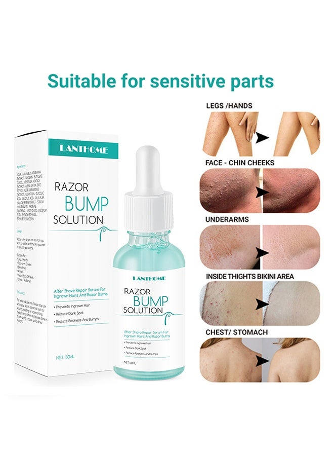 Lanthome Razor Bump Solution,Hair Growth Inhibitor Safe and Gentle Repair serum, Delay Hair Growth, No Black Spots 30ml - Image 2
