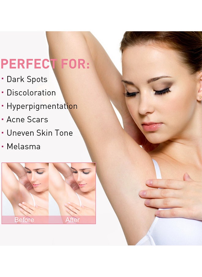 West&Month Niacinamide Intimate Areas Tightening Cream, Dark Spot Remover, Underarm Cream, Neck, Back, Legs, Elbows, Private Areas, Premium Botanical Ingredients, 50ML  - Image 4
