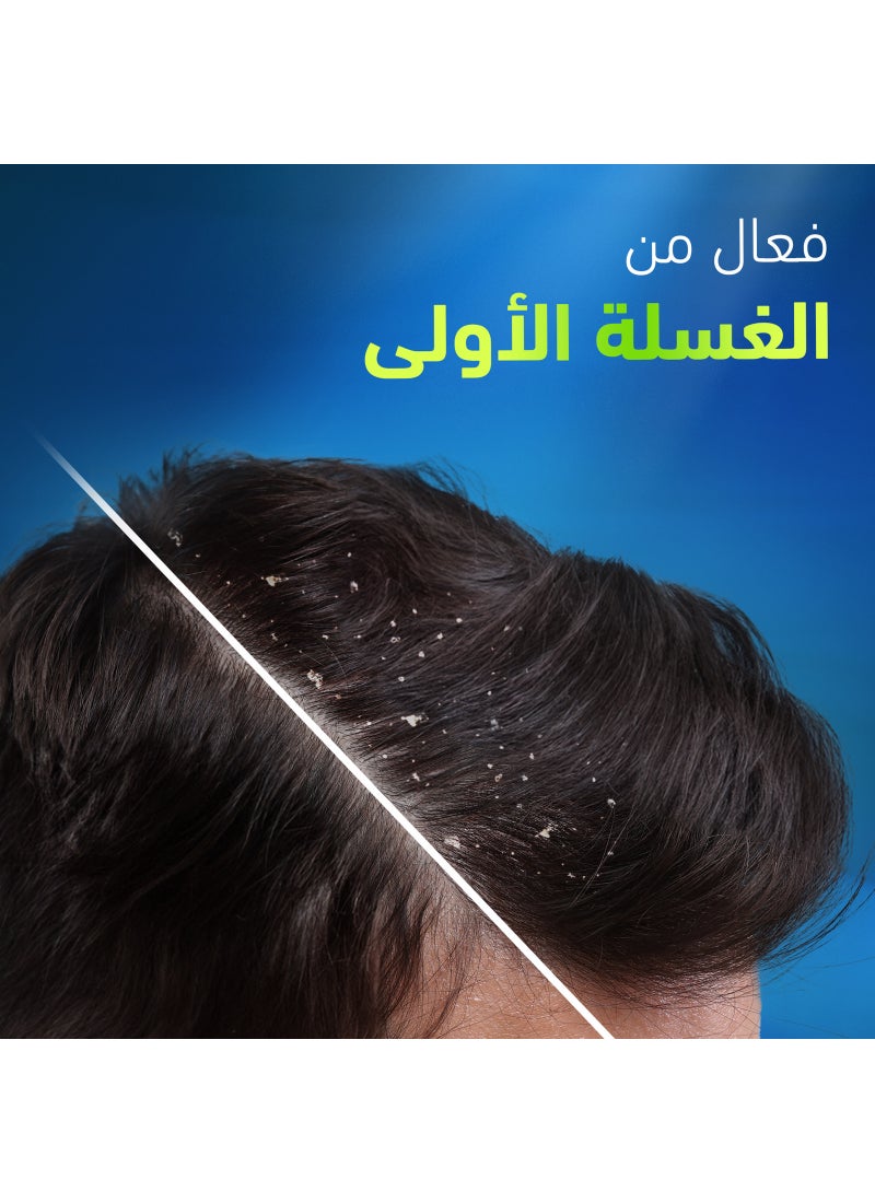 Head & Shoulders Anti-Dandruff Shampoo Deep Clean For Severe Oily Scalp 400ml - Image 5