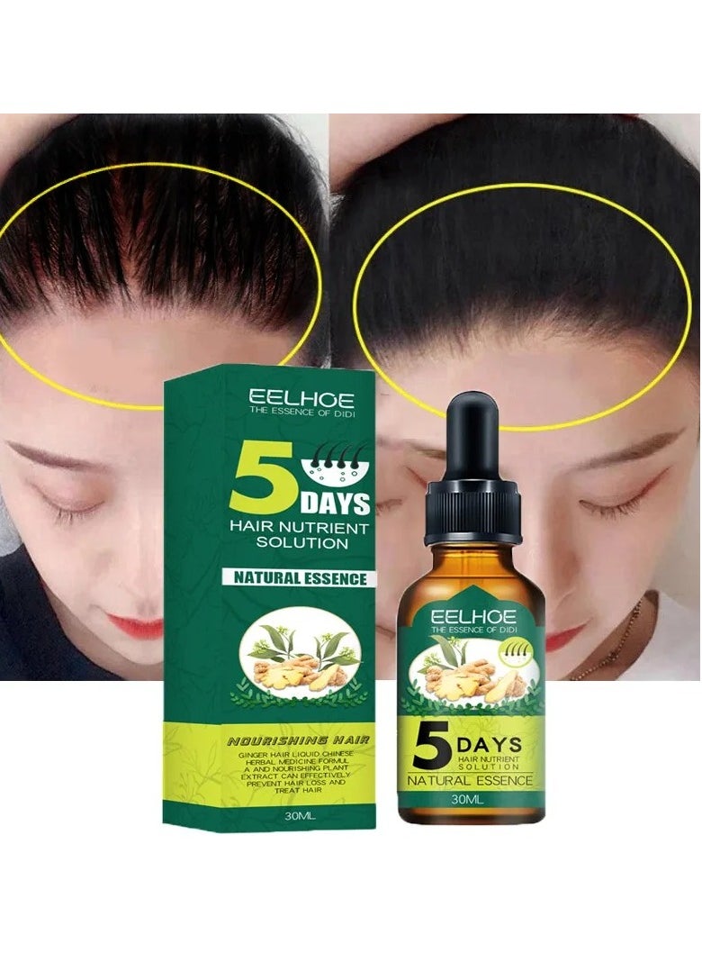EELHOE - Ginger Fast Hair Growth Oil, 30ml Nourishing Essential Oil For Hair Care, Anti Hair Loss Natural Essence Oil, Head Hair Essence Serum For Hair Thicking Hair Growth, Treating Baldness - Image 1