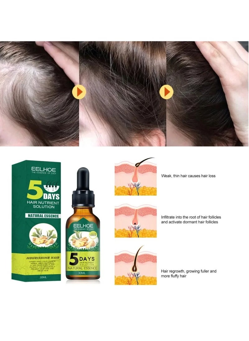 EELHOE - Ginger Fast Hair Growth Oil, 30ml Nourishing Essential Oil For Hair Care, Anti Hair Loss Natural Essence Oil, Head Hair Essence Serum For Hair Thicking Hair Growth, Treating Baldness - Image 1
