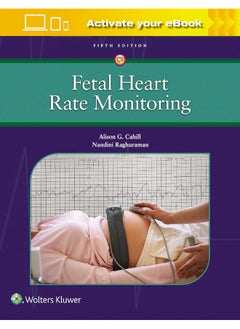 Fetal Heart Rate Monitoring 