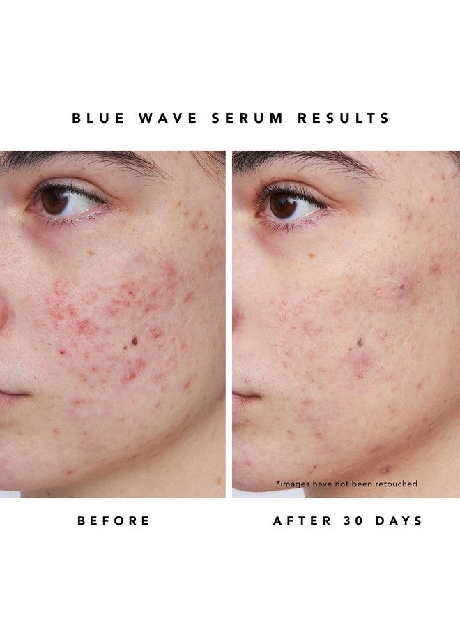 HERBIVORE Blue Besties Duo - 2-Step Treatment for Acne-Prone Skin, Aquarius Cleanser (50 mL) & Blue Wave Serum (10 mL), Plant-Based, Vegan, Cruelty-Free - Image 4