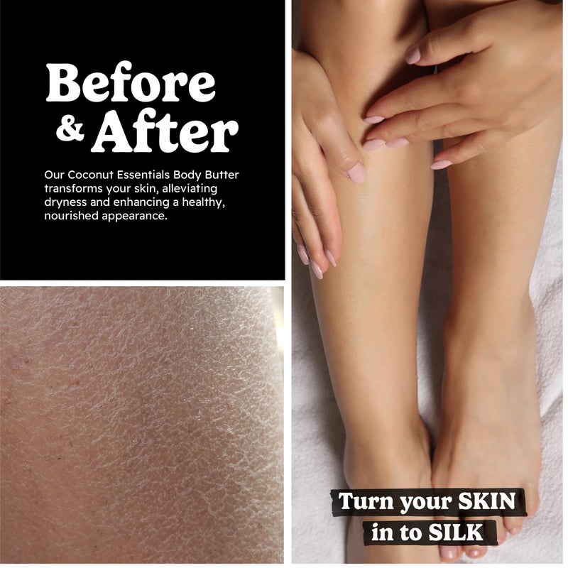 Coconut Essentials - Moisturizing Body Butter, Gluten and Paraben Free, with Coconut Oil, Peppermint, Vitamin E, Shea Butter, Almond, and Sunflower Oil, Body Lotion for Beautiful & Glowing Skin, 8 oz - Image 5