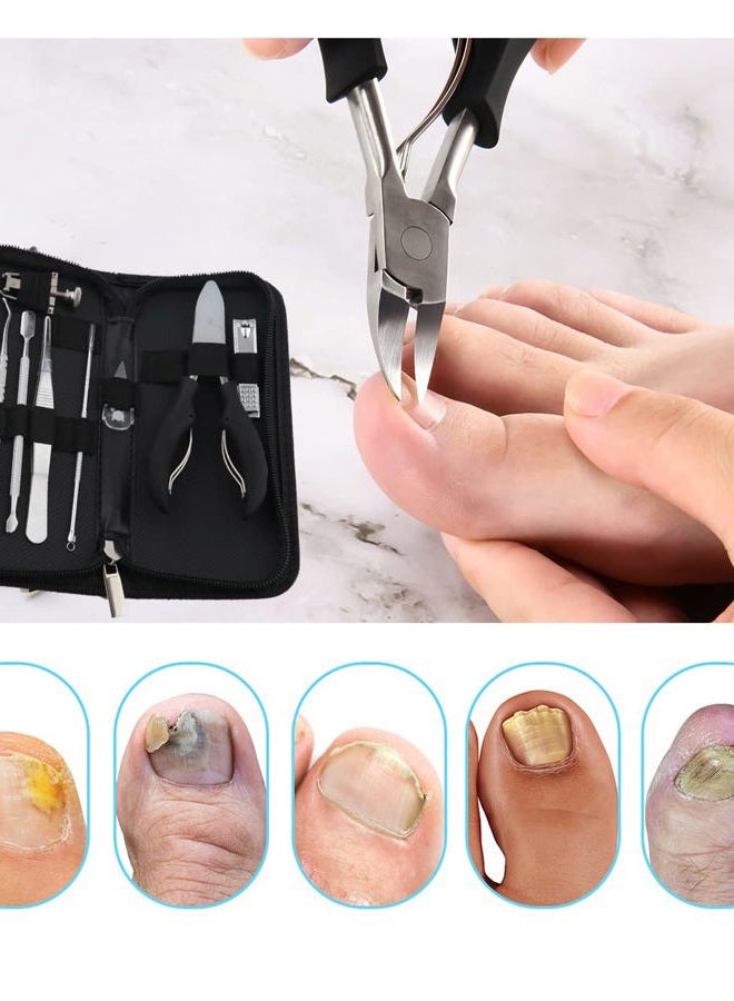 Bcabo Upgraded 6Pcs/set Ingrown Toenail Tools Kit, Premium Nail Treatment Foot Tool, Ingrown Toenail Removal Correction Clippers, Surgery Grade Ingrown Toe Nail File and Lifter, Professional Pedicure Tools - Image 3