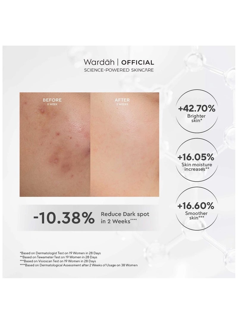 وردہ سيروم كريستال سيكريت 3% ترانيكساميك كومبلكس ألفا أربوتين لتصحيح البقع الداكنة 20 مل - Image 5