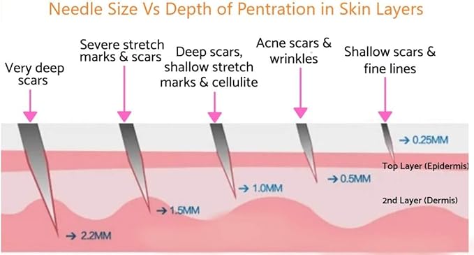 Derma roller system Ymenglei Microneedle Tberapy System 540 Needles 100mm Model NrMT10 Skin Roller Skin Rejuvenation Anti Ageing Scar Acne marks Cellulite Treatment Black - Image 4