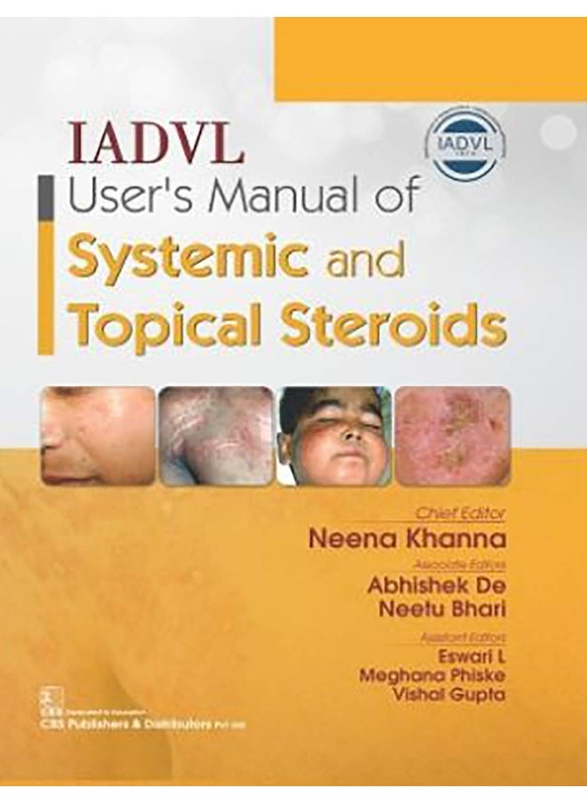 IADVL User's Manual of Systemic and Topical Steroids 