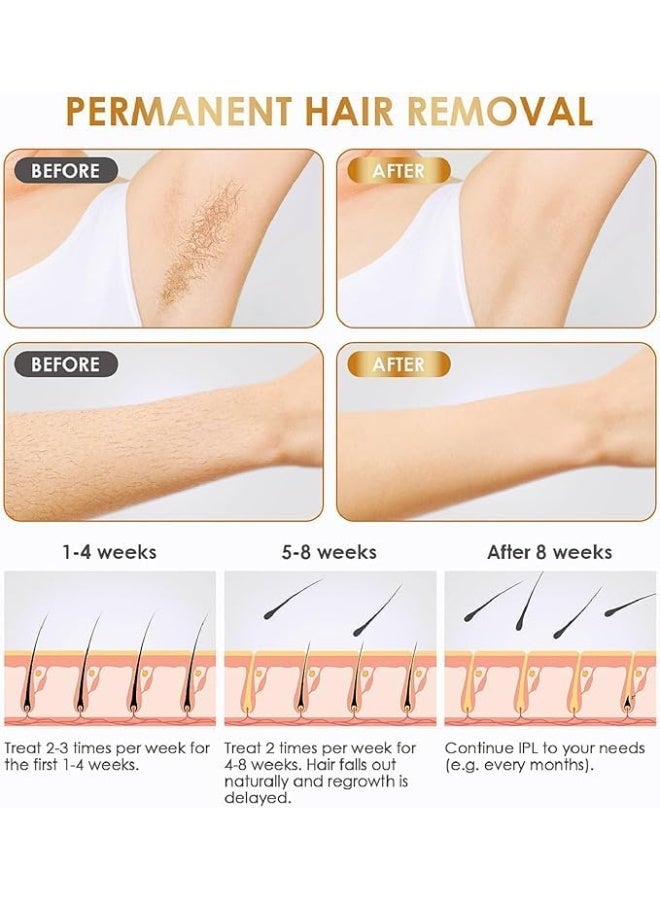 جهاز ازالة الشعر بالليزر، مزيل دائم بدون الم لتقليل نمو الشعر في المنزل لكامل الجسم SE4 - Image 2