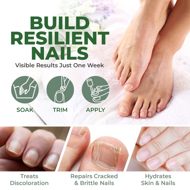 Perfecto Toenail Treatment with Tea Tree Oil - Fingernail and Toe Nail Treatment Extra Strength - Nail Repair Foot Nail Treatment - Renews Foot, Yellow & Cracked Nails - Image 2