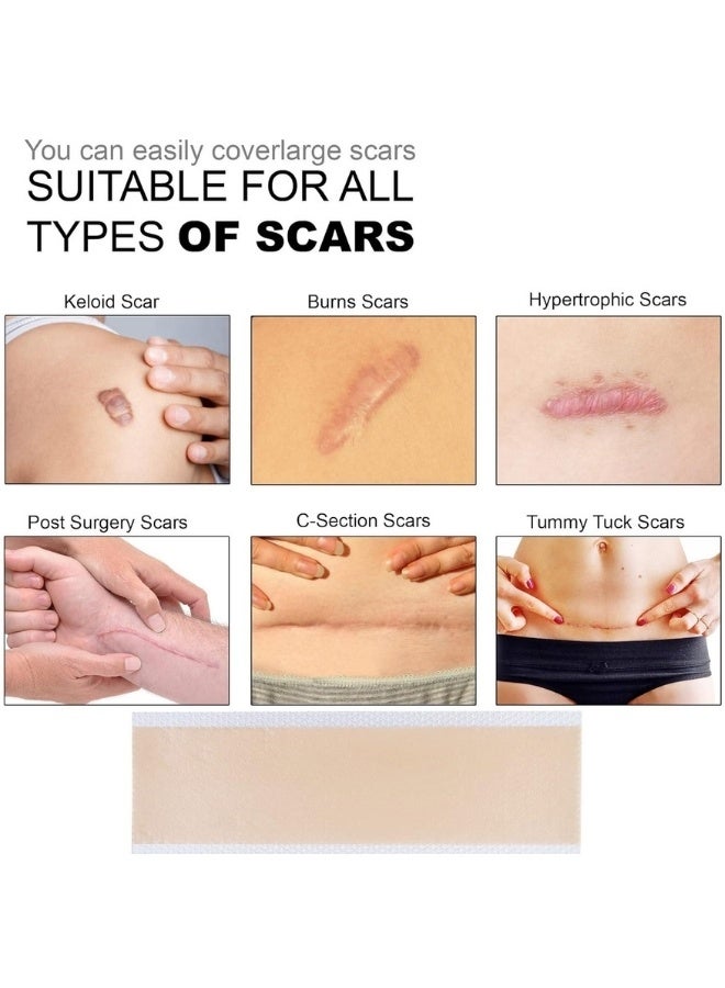 Hodaf Silicone Scar Patch Fade Stretch Marks Repairing Sheets - Image 3