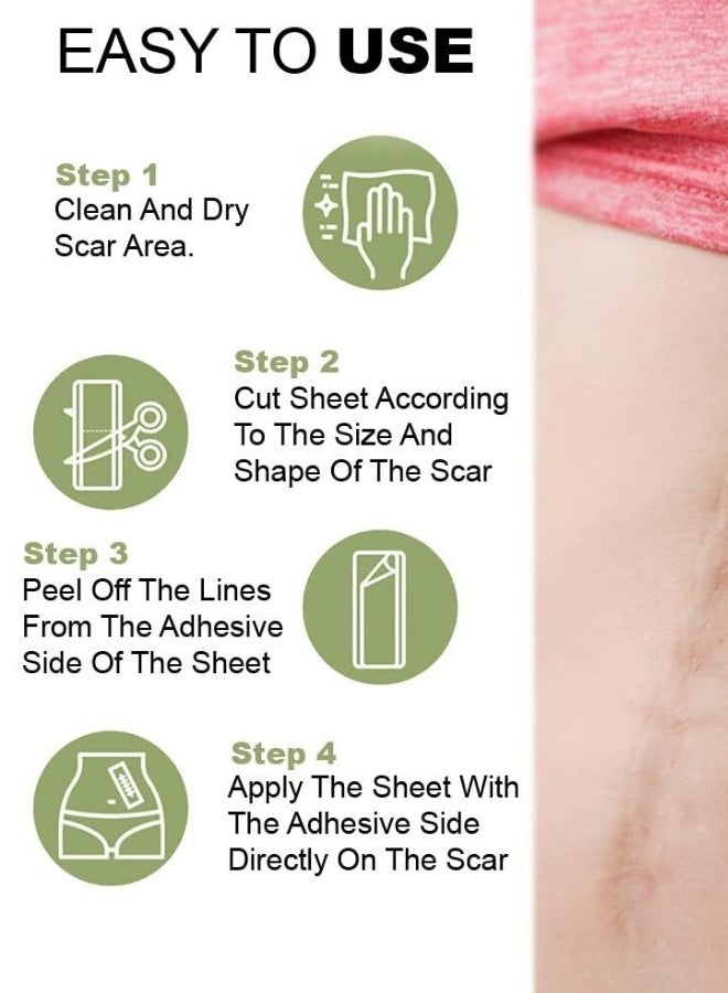 Hodaf Silicone Scar Patch Fade Stretch Marks Repairing Sheets - Image 2