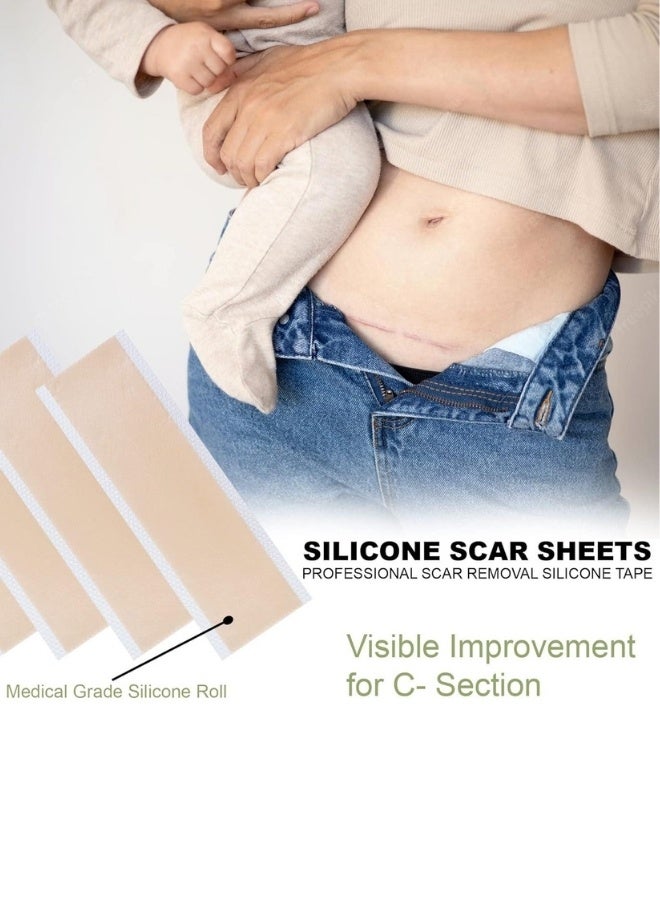 Hodaf Silicone Scar Patch Fade Stretch Marks Repairing Sheets - Image 5