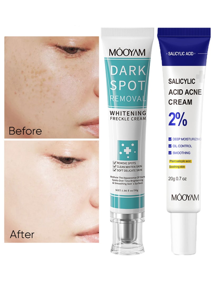 MOOYAM 2% Salicylic Acid Acne Cream & Dark Spot Remover for Face and Body with Plant Salicylic Acid Reduces Hyperpigmentation and Controls Oil for All Skin Types - Image 1