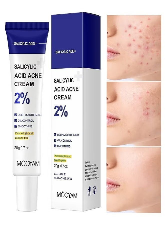 MOOYAM 2% Salicylic Acid Acne Cream & Dark Spot Remover for Face and Body with Plant Salicylic Acid Reduces Hyperpigmentation and Controls Oil for All Skin Types - Image 3