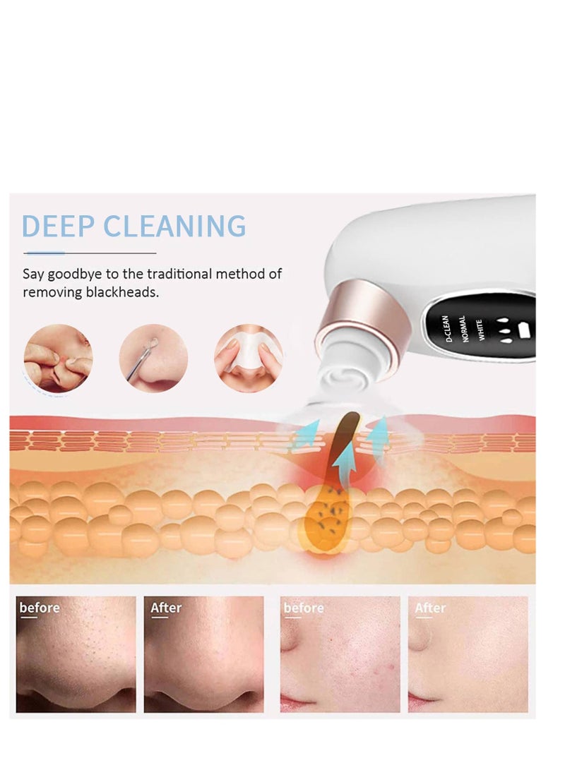 Blackhead Remover Pore Vacuum, 2023 Newest Water Circulation Pore Vacuum Cleaner Pimple Extractor Tools with 6 Suction Heads,3 Gears Adjustable Beauty Device for Men and Women