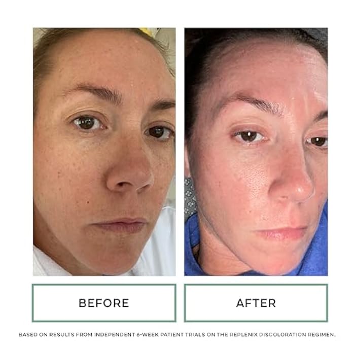 Replenix Glycolic Acid Resurfacing Skin Peel, Medical-Grade Facial Peeling Pads for Discoloration & Acne (60 ct.) - Image 5