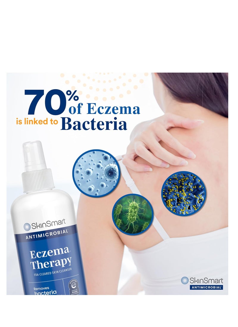 SkinSmart Antimicrobial - SkinSmart antimicrobial eczema therapy with hypochlorous acid removes bacteria so skin can heal for adults kids and seniors 8 ounce clear spray - Packing May Vary - Image 1