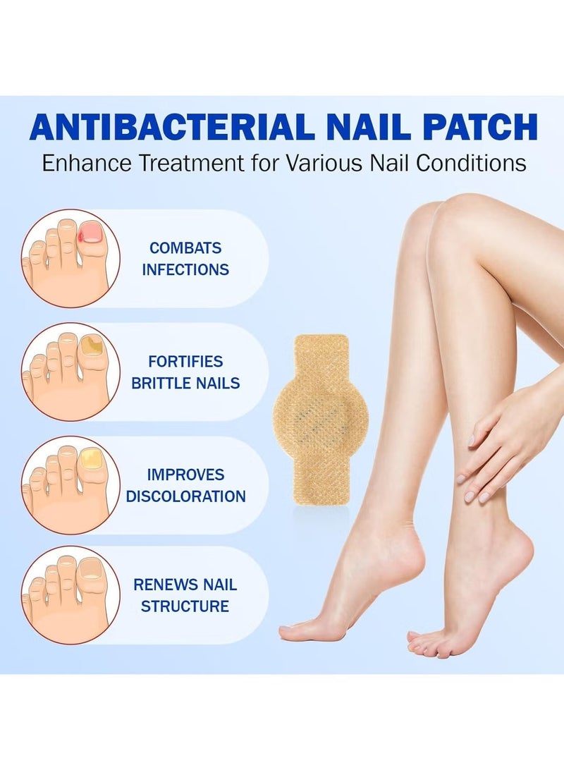 JUE-FISH Fungal Nail Repair Patches – Effective Care Solution for Healthy, Strong Toenails. Easy-to-Use, Fast-Acting & Long-Lasting Results - Image 2